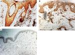 IL-17A Antibody in Immunohistochemistry (Paraffin) (IHC (P))