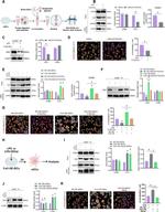 ICAM-1 Antibody in Western Blot (WB)