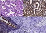 CD133 Antibody in Immunohistochemistry (Paraffin) (IHC (P))