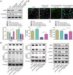 AIM2 Antibody in Western Blot (WB)