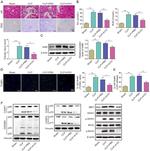 AIM2 Antibody in Western Blot (WB)