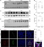 Phospho-GCN2 (Thr899) Antibody in Western Blot (WB)