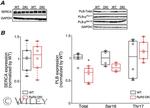 Phospholamban Antibody in Western Blot (WB)
