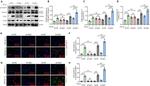 COL1A1 Antibody in Western Blot (WB)