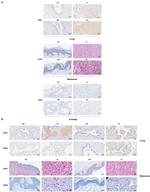 MDM2 Antibody in Immunohistochemistry (Paraffin) (IHC (P))