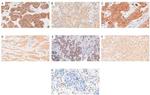 RBMS3 Antibody in Immunohistochemistry (Paraffin) (IHC (P))