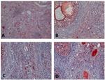 Bcl-2 Antibody in Immunohistochemistry (Paraffin) (IHC (P))