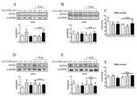NOX4 Antibody in Western Blot (WB)