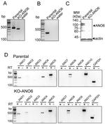 ANO6 Antibody in Western Blot (WB)