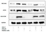 IFNAR2 Antibody in Neutralization (Neu)