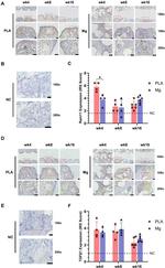 TGF beta-1 Antibody in Immunohistochemistry (Paraffin) (IHC (P))