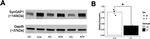 SynGAP Antibody in Western Blot (WB)