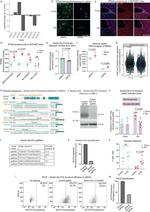 GLUT4 Antibody in Western Blot (WB)