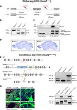 KCNH7 Antibody in Western Blot (WB)