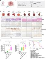 Mesothelin Antibody in Immunohistochemistry (Paraffin) (IHC (P))
