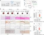 Mesothelin Antibody in Immunohistochemistry (Paraffin) (IHC (P))