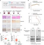 Mesothelin Antibody in Immunohistochemistry (Paraffin) (IHC (P))