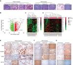 Cytokeratin 18 Antibody in Immunohistochemistry (Paraffin) (IHC (P))
