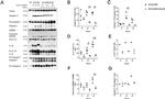 IL-1 beta Antibody in Western Blot (WB)