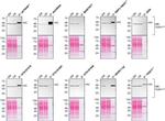 CK2 alpha-1 Antibody in Western Blot, Immunoprecipitation (WB, IP)