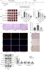 Parkin Antibody in Western Blot (WB)