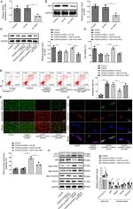 Parkin Antibody in Western Blot (WB)