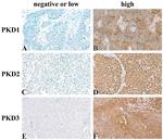 PRKD2 Antibody in Immunohistochemistry (Paraffin) (IHC (P))