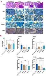 PD-L1 Antibody in Immunohistochemistry (Paraffin) (IHC (P))