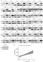 TRPM8 Antibody in Western Blot (WB)