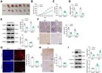 RAD51 Antibody in Immunohistochemistry (Paraffin) (IHC (P))