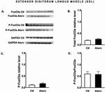 FOXO3A Antibody in Western Blot (WB)