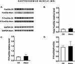 FOXO3A Antibody in Western Blot (WB)