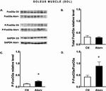 FOXO3A Antibody in Western Blot (WB)