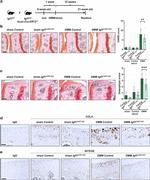 Aggrecan Neo Antibody in Immunohistochemistry (Paraffin) (IHC (P))