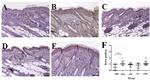 TSLP Antibody in Immunohistochemistry (Paraffin) (IHC (P))