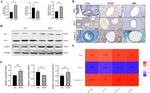 Bcl-2 Antibody in Western Blot, Immunohistochemistry (Paraffin) (WB, IHC (P))
