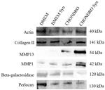 MMP1 Antibody in Western Blot (WB)