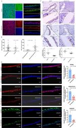 Adiponectin Receptor 1 Antibody in Immunohistochemistry (Paraffin) (IHC (P))
