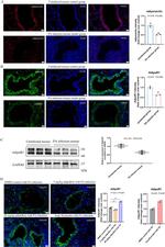 Adiponectin Receptor 1 Antibody in Western Blot (WB)