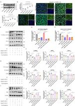 Adiponectin Receptor 1 Antibody in Western Blot (WB)