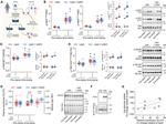 GLUT4 Antibody in Western Blot (WB)