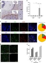 S100A9 Antibody in Immunohistochemistry (IHC)
