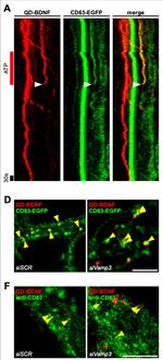 Mouse IgG (H+L) Highly Cross-Adsorbed Secondary Antibody in Immunocytochemistry (ICC/IF)