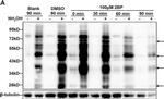 Rabbit IgG (H+L) Secondary Antibody in Western Blot (WB)