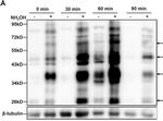 Rabbit IgG (H+L) Secondary Antibody in Western Blot (WB)