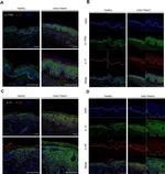 Mouse IgG (H+L) Highly Cross-Adsorbed Secondary Antibody in Immunohistochemistry (Paraffin) (IHC (P))
