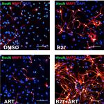 Mouse IgG (H+L) Highly Cross-Adsorbed Secondary Antibody in Immunocytochemistry (ICC/IF)