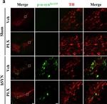 Mouse IgG (H+L) Highly Cross-Adsorbed Secondary Antibody in Immunohistochemistry (IHC)
