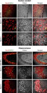 Mouse IgG (H+L) Highly Cross-Adsorbed Secondary Antibody in Immunocytochemistry (ICC/IF)