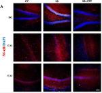 Rabbit IgG (H+L) Highly Cross-Adsorbed Secondary Antibody in Immunohistochemistry (Frozen) (IHC (F))